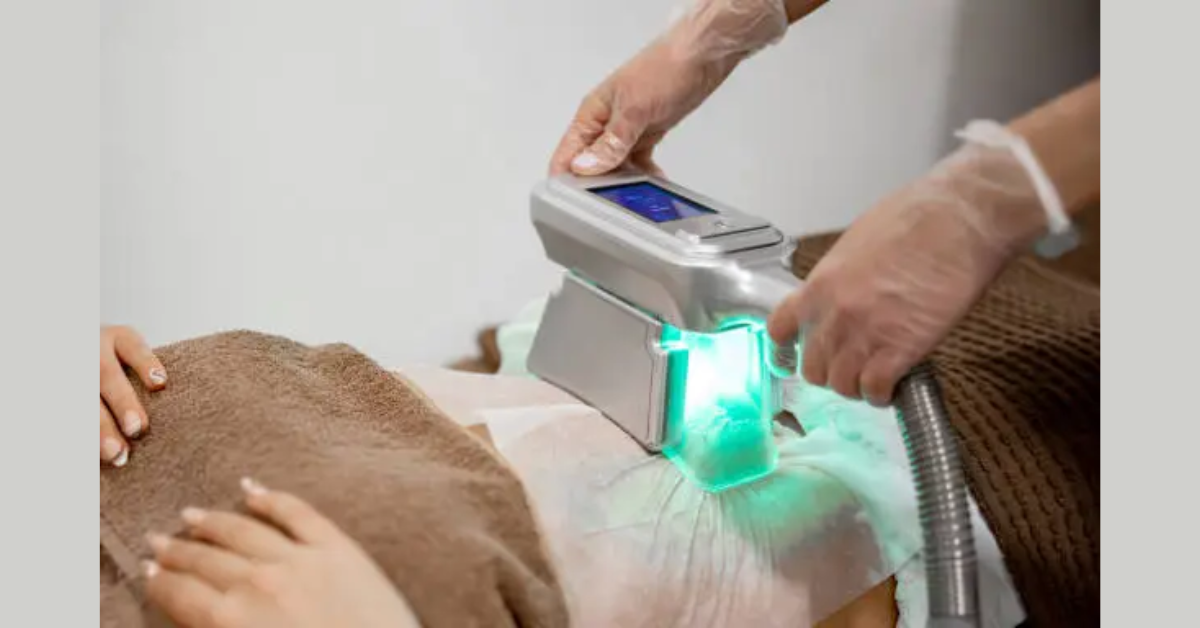 Cryoslimming