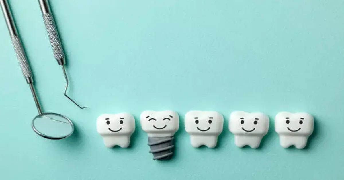 Dental Implants
