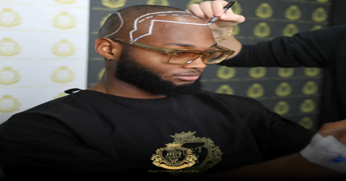 Hair Transplant Clinics