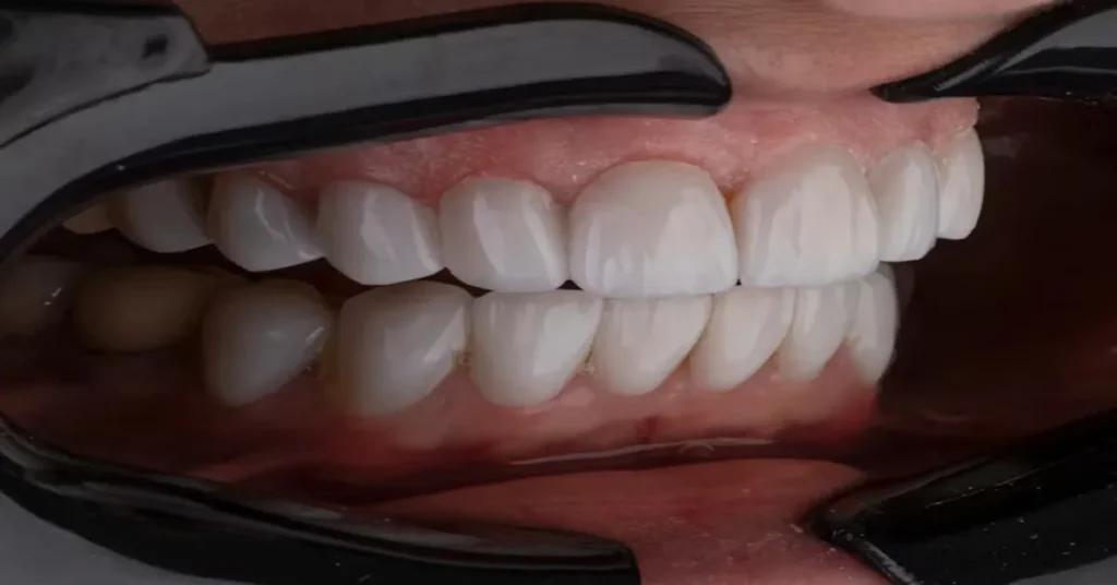 Restore Smiles