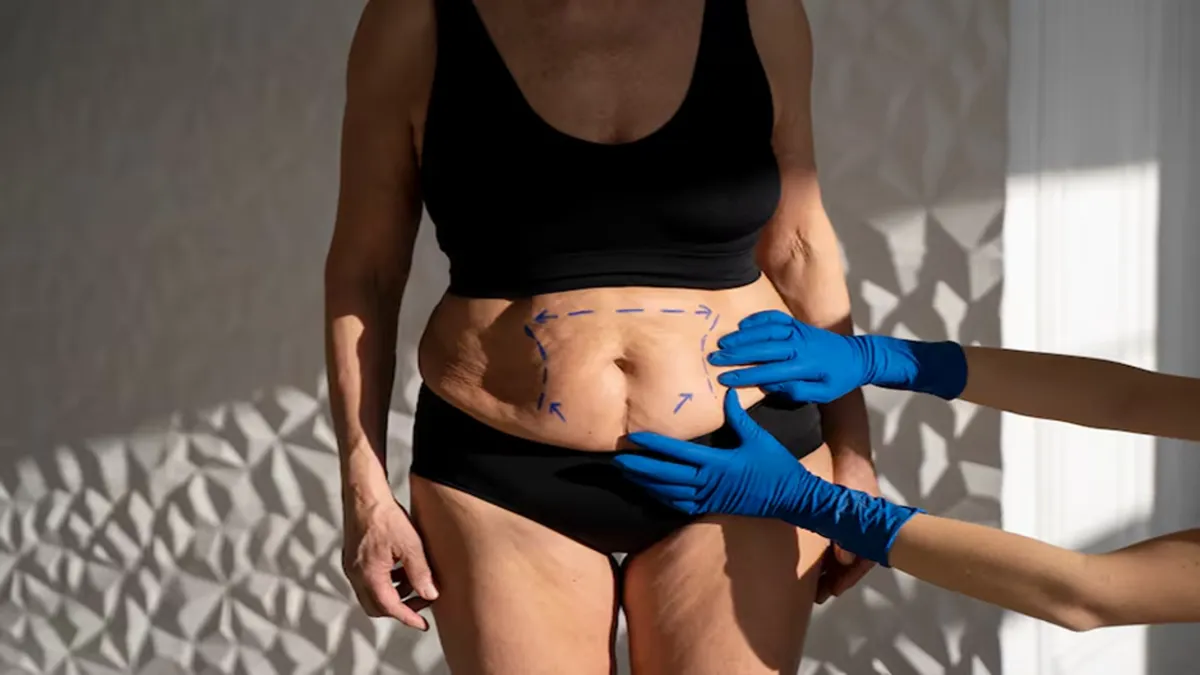 Body Surgery in Albury
