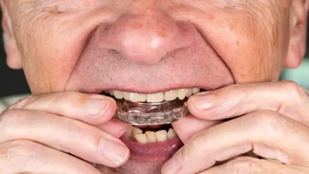 Myths About Bruxism