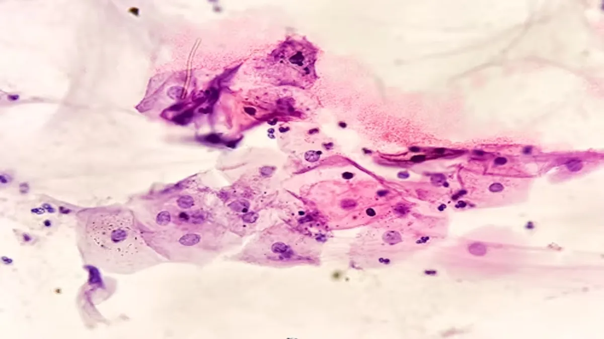 Gastroshiza